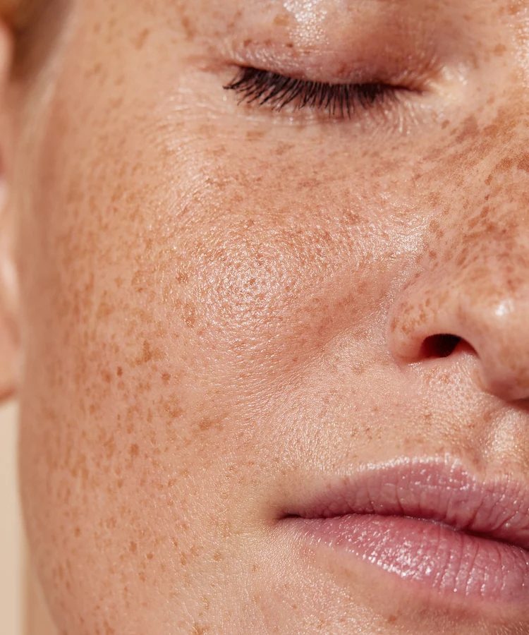 Woman with natural freckled skin and closed eyes showcasing healthy skincare and anti-aging beauty routine